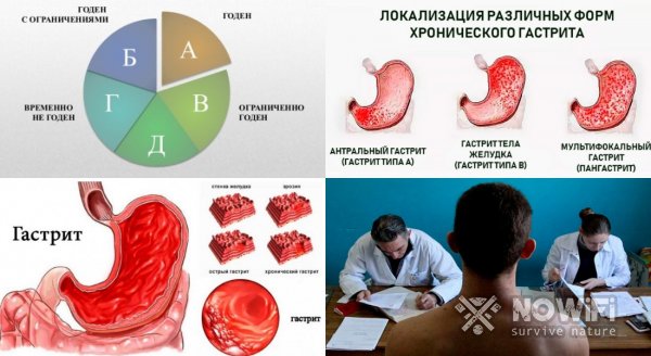 Берут армию с гастритом в 2021 году