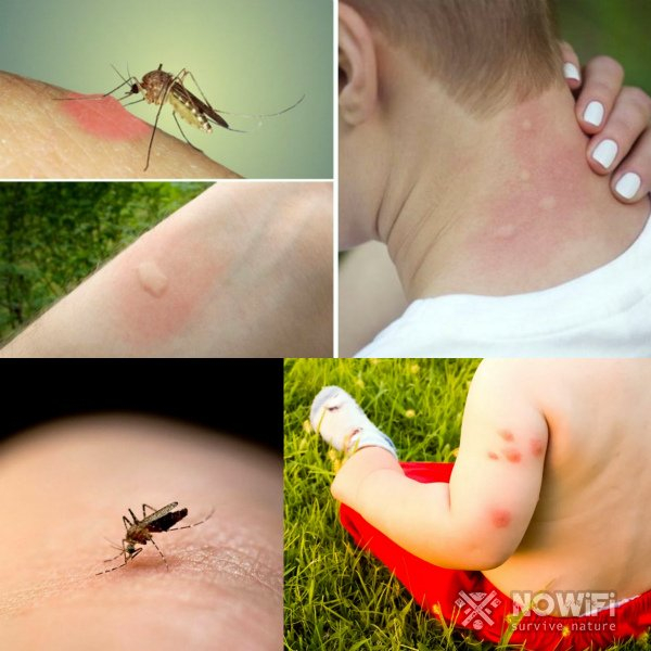 Фото укусов насекомых с описанием