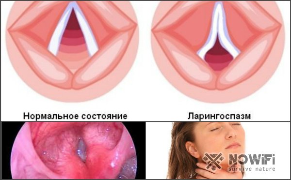 Первая помощь при утоплении